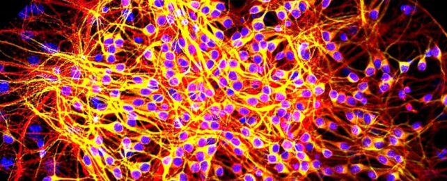 TauProteinsInRedLineTheBranchesOFNeurons-642x260