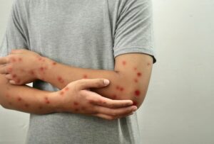 QYYH7OWD4VH3TL3AEEMOAIXLAU