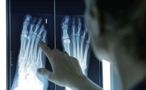 podologos-problemas-pies-deformidades-huesos-010426